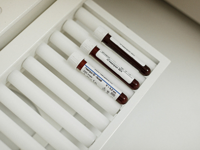 Сахарный диабет 2 типа - Санаторий и курорт "СИБИРЬ", Тюмень