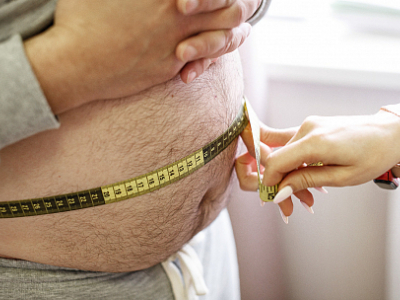 Ожирение (все формы ожирения, в т. ч. последствия избыточности питания, метаболический синдром) - Санаторий и курорт "СИБИРЬ", Тюмень